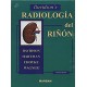 Davidson´s Radiología del Riñón