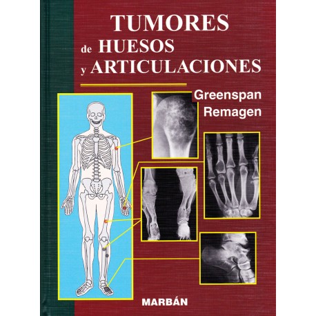 Greenspan & Remagen - Tumores de huesos y articulaciones