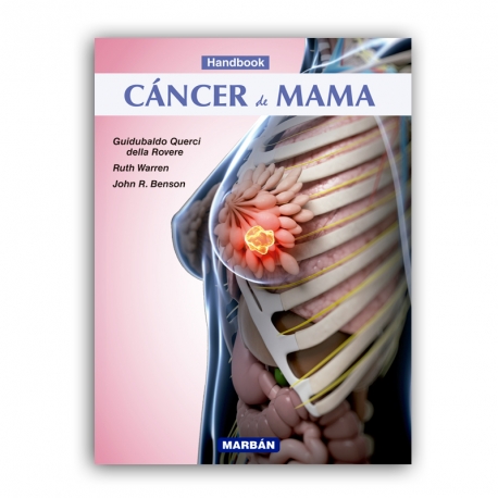 Querci della Rovere - Cáncer de Mama