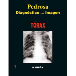 Pedrosa - Tórax