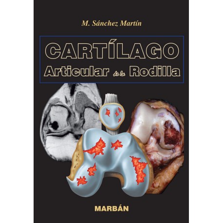 Sánchez Martín - Cartílago Articular de la Rodilla