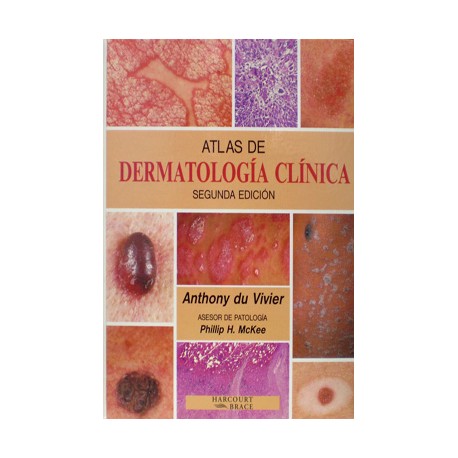 Anthony du Vivier - Atlas de Dermatología Clínica