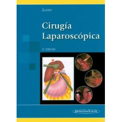 Zucker - Cirugía Laparoscópica