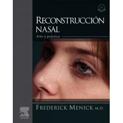 Menick - Reconstrucción Nasal