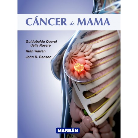 Querci della Rovere - Cáncer de Mama