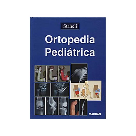 Ortopedia Pediátrica Outlet - Existencias limitadas