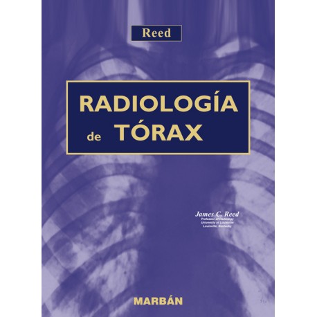 Reed - Radiología de Tórax