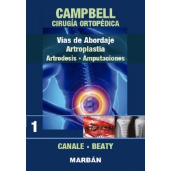 Vías de abordaje, Artroplastia, Artrodesis, Amputaciones. - Campbell Cirugía Ortopédica. Tomo 1 