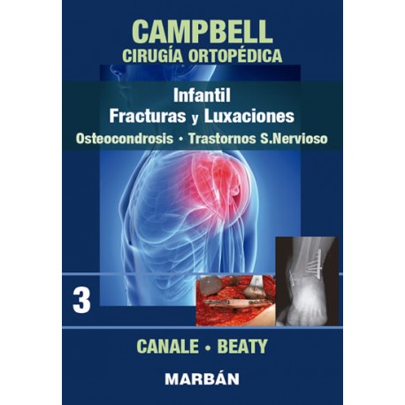 Campbell - Cirugía Ortopédica. Tomo 3: Infantil. Fracturas y Luxaciones,...