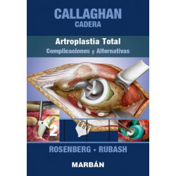 Callaghan - Cadera. Tomo 2: Artroplastia Total,... 