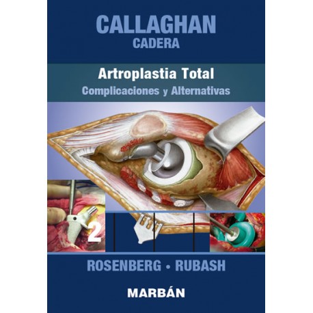 Callaghan - Cadera. Tomo 2: Artroplastia Total,... 