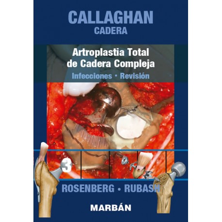 Callaghan - Cadera. Tomo 3: Artroplastia Total de cadera compleja 