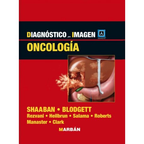 Shaaban - Oncología