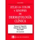 Fitzpatrick / Atlas de Dermatología, 4ª Ed.