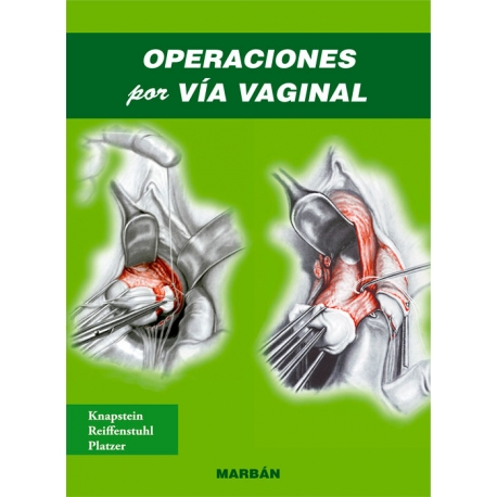 Knapstein / Formato"Premium" - Operaciones por vía vaginal