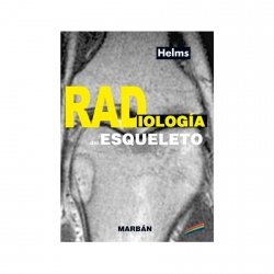 Helms / Formato Handbook - Radiología del Esqueleto